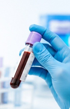 immunology-blood-test